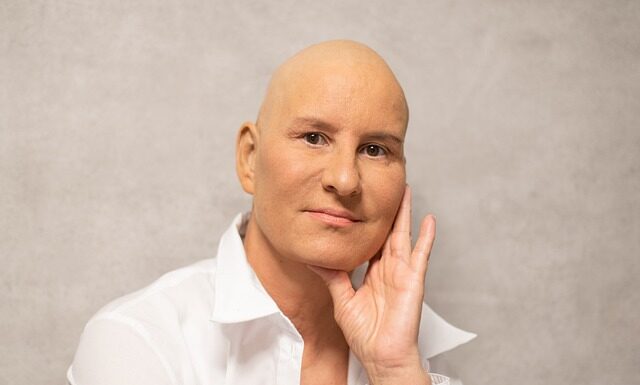 Ile kosztuje jeden cykl chemioterapii?